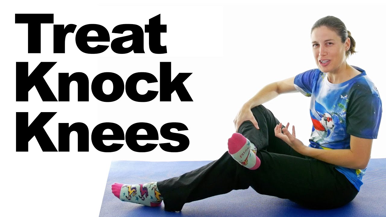 Treat Knock Knees with Easy Stretches & Exercises
