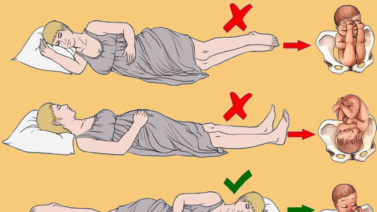 Wrong Sleeping Positions For Pregnant Women Harm the Fetus | Best Sleeping Position during Pregnancy