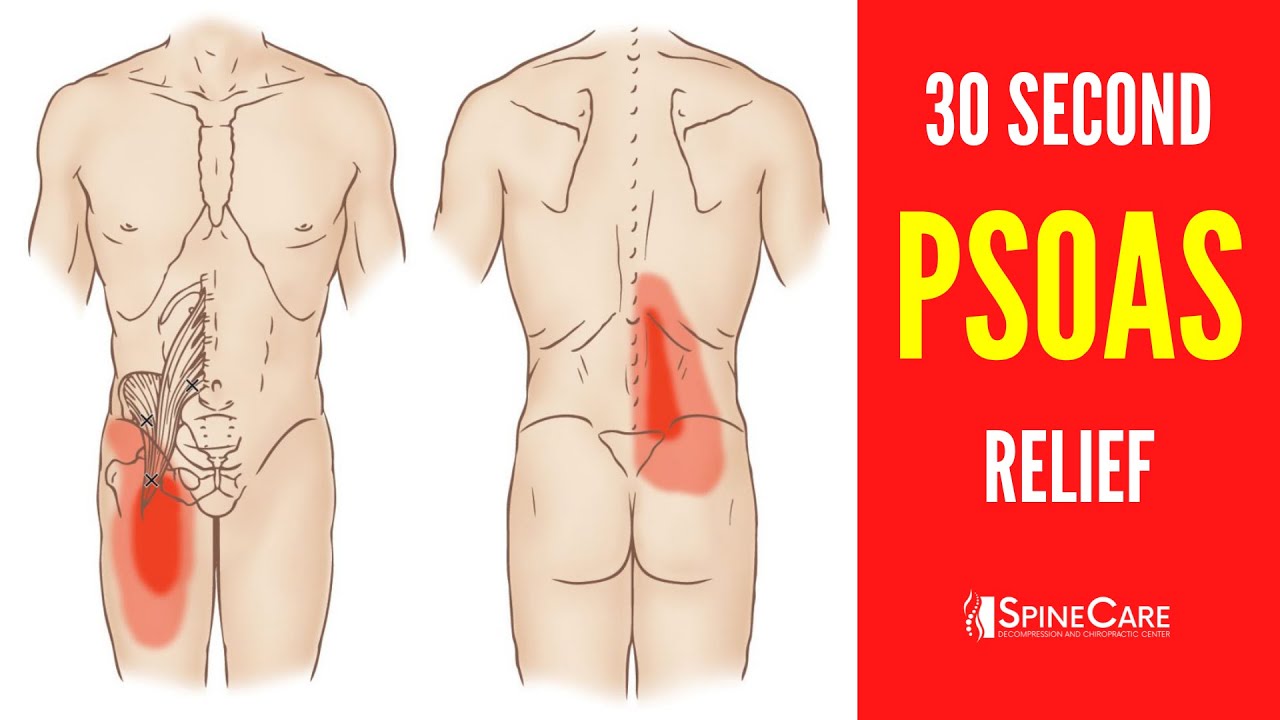 How to Fix a Tight Psoas Muscle in 30 SECONDS