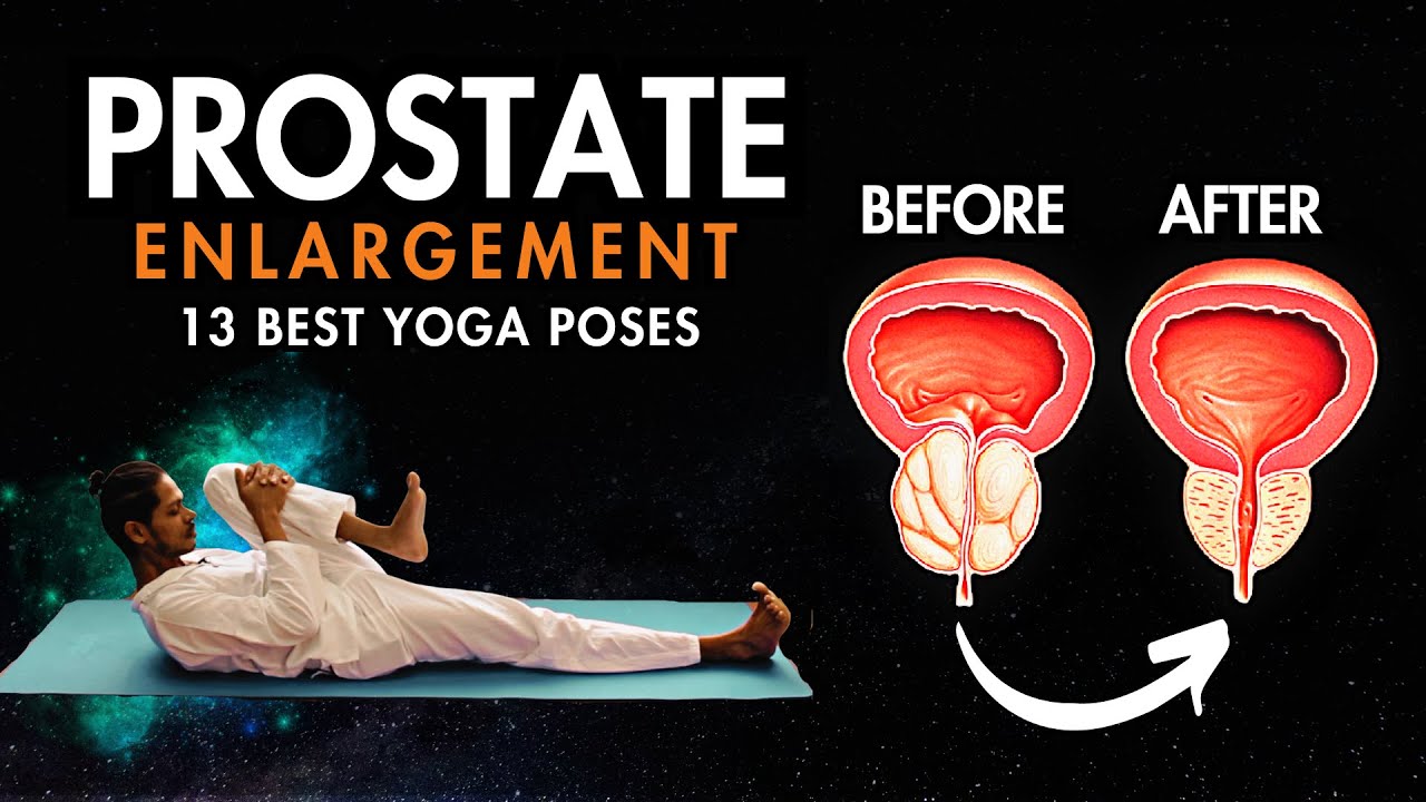 Yoga for Prostate Problems | 13 Best Prostate Yoga Exercises